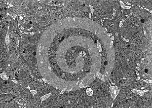 Chylomicrons. Intestinal cells photo