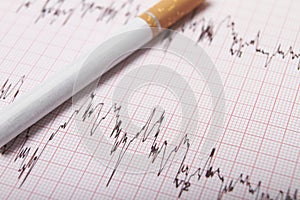 Cigarette On ECG Printout