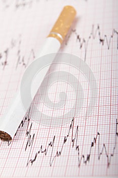 Cigarette On ECG Printout