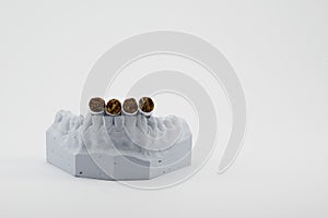 Cigarettes and teeth model