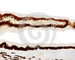 Eye. Ciliary body epithelium