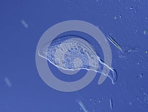 Ciliat in drops of water