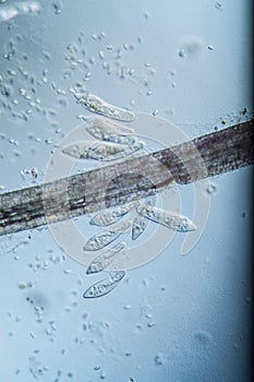 Ciliate plankton unicellular