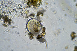 ciliate spore in a soil sample in on a farm