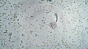 Ciliate vorticella feeds on bacteria in troubled waters
