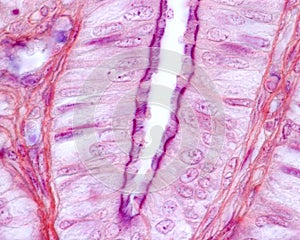 Ciliated columnar epithelium. Fallopian tube