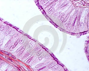 Ciliated columnar epithelium photo