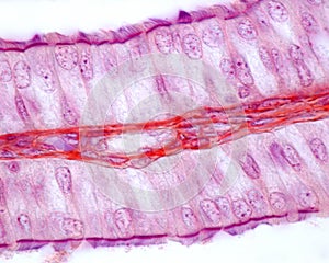 Ciliated epithelium