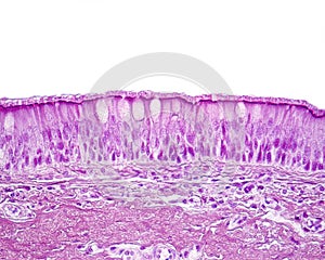 Ciliated pseudostratified columnar or respiratory epithelium