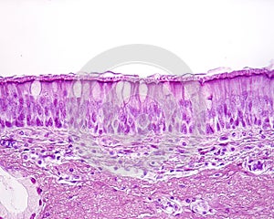 Ciliated pseudostratified columnar or respiratory epithelium photo