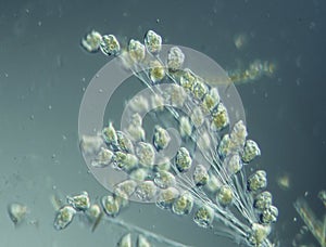 Ciliates and amoebas in drops of water