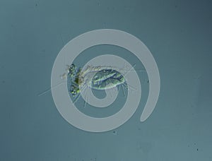 Ciliates in drops of water