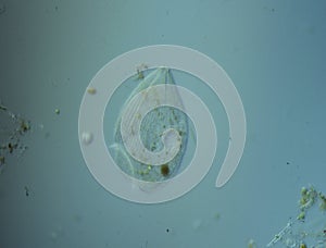 Ciliates in drops of water