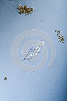 Ciliates foraging in drops of water