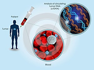 Circulating tumor DNA