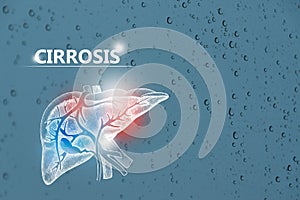 Cirrosis - DiagnÃÂ³stico y tratamiento, lista de comprobaciÃÂ³n mÃÂ©dica. Fondo texturizado y espacio de copia vacÃÂ­o para texto photo