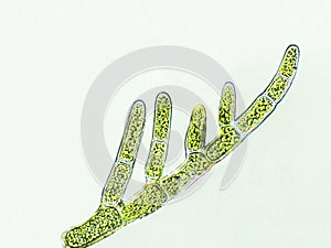 Cladophora sp. algae under microscopic view, green algae