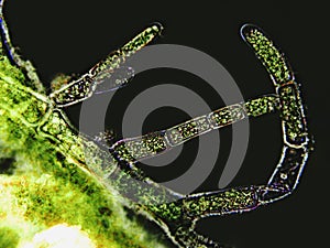 Cladophora sp. algae under microscopic view, Filamentous green algae, dark background