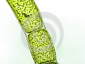 Cladophora sp. algae under microscopic view, green algae