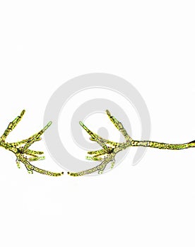 Cladophora sp. algae under microscopic view, green algae