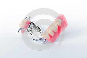 Clasp prosthesis with clam fixation