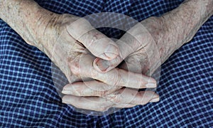 Clasped hands of Asian man. Concept of rheumatoid arthritis, osteoarthritis or joint pain