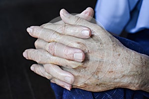 Clasped hands of Asian man. Concept of rheumatoid arthritis, osteoarthritis or joint pain