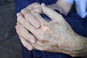 Clasped hands of Asian man. Concept of rheumatoid arthritis, osteoarthritis or joint pain