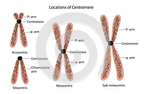 Classification of chromosome photo