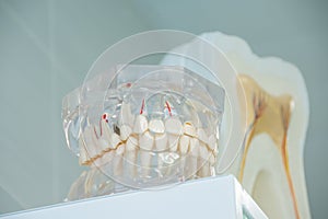 Clean teeth denture, dental cut of the tooth, tooth model, in dentist`s office.