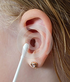 Cleaning a child`s ear with a cotton swab from contamination of the ear drum and ear canal. Earwax as protection against