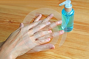 Cleaning Hands with Sanitizer by Right Palm Rubbing over Left Dorsum with Fingers Interlaced for Hand Hygiene
