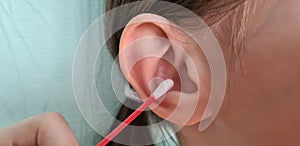 Cleaning and hygiene of child ear with cotton swab from contamination of eardrum and ear canal photo