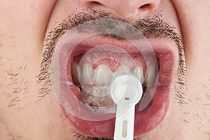 Cleaning teeth with electrical brush