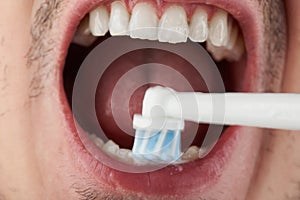 Cleaning teeth with electrical brush