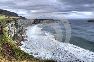 CLIFFS AND WAVES AT CARRICK-A-REDE photo