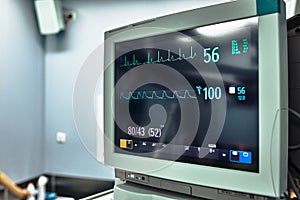 Clinical trial results on a monitor screen. Medical equipment. Monitor vital indicators. Heart rate, mechanical