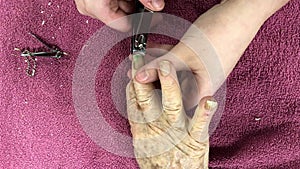 Clipping cutting fingernail of senior woman by young caregiver with clippers. Onychomycosis or tinea unguium, common in elderly,