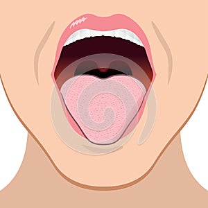 Close illustration of a person with an open mouth