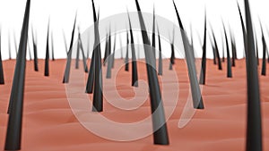 Close Up 3d Illustration of Human Scalp With Black Hair Strands On White Background