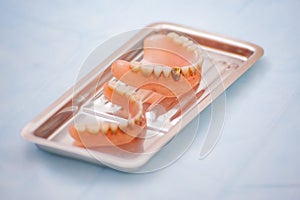 Close-up an acrylic denture prosthesis of the upper and lower jaws of a man