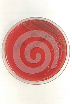 Close up agar plate and biochem test.