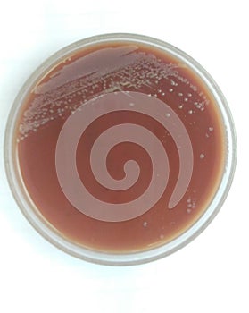 Close up agar plate and biochem test.