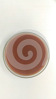 Close up agar plate and biochem test.