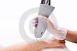 Close up of arm laser hair removal session with beauty technician and female patient, epilating after shaving, in a cosmetology