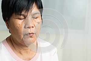 Close-up of Asian elder woman face with wrinkled skin condition