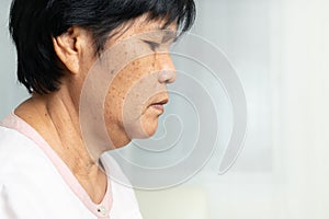 Close-up of Asian elder woman face with wrinkled skin condition. side view