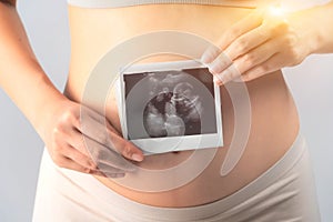 Close up Asian pregnant woman and ultrasound film