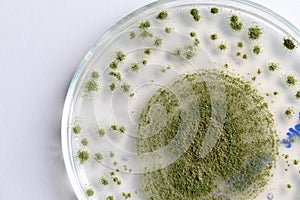 Aspergillus oryzae is a filamentous fungus, or mold that is used in food production, such as in soybean fermentation. photo
