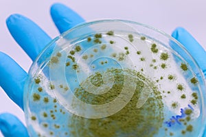 Aspergillus oryzae is a filamentous fungus,  under the microscope in laboratory.